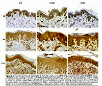 Interleukin-31 is overexpressed in skin and serum in cutaneous T-cell lymphomas but does not correlate to pruritus