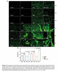 RIPK1 downregulation enhances neutrophil extracellular
traps in psoriasis